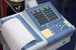 El electrocardiograma (ECG) en el diagnostico de la Insuficiencia Cardiaca.